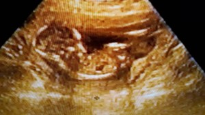20190406_102408
